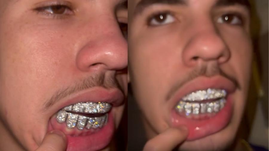 LAMELO BALL SHOWS OFF HIS NEW GRILLS - YouTube