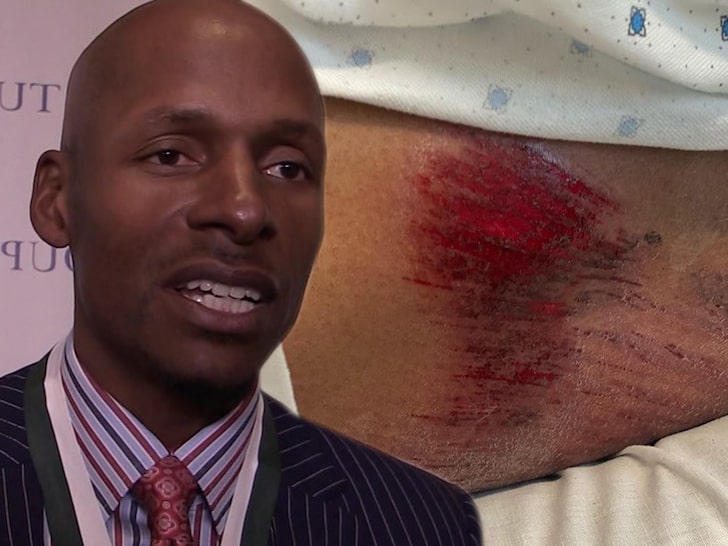 Ray Allen Suffers Bloody Injuries In Bicycle Crash, &#39;My Helmet Saved Me&#39;